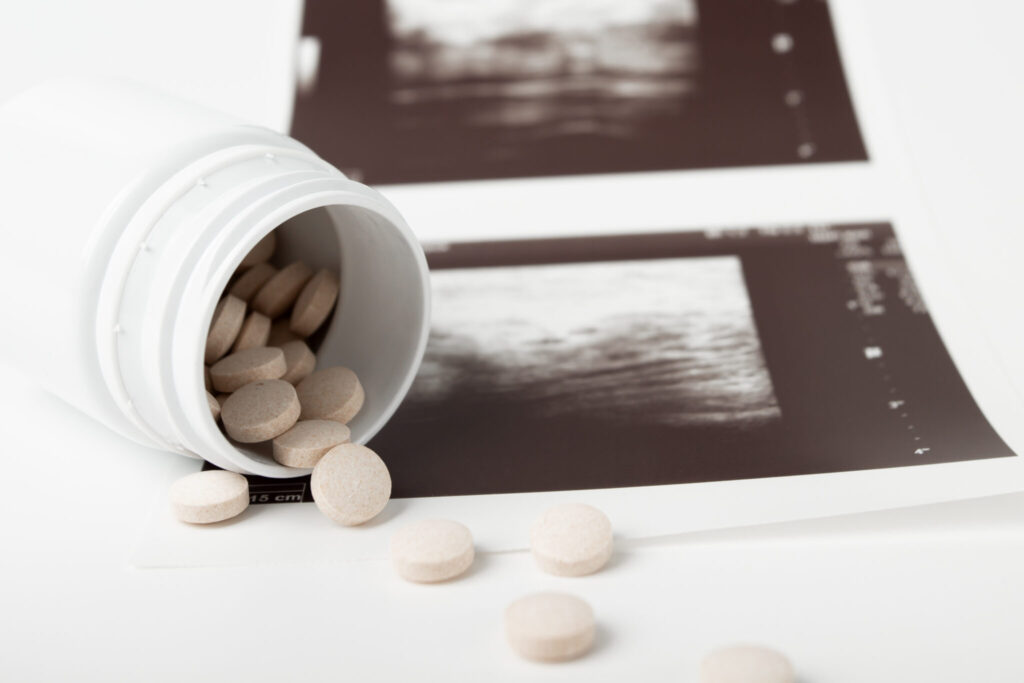 Abortion tablets, pregnancy termination, pharmaceutical intervention, healthcare option